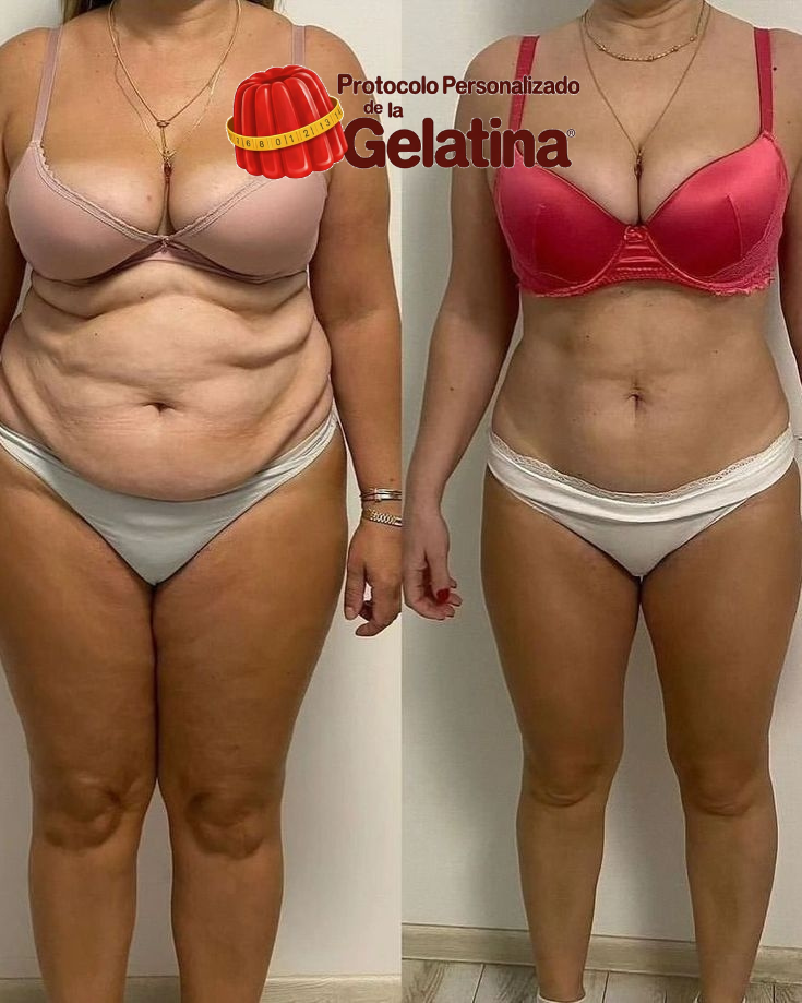 Antes e Depois Isabel